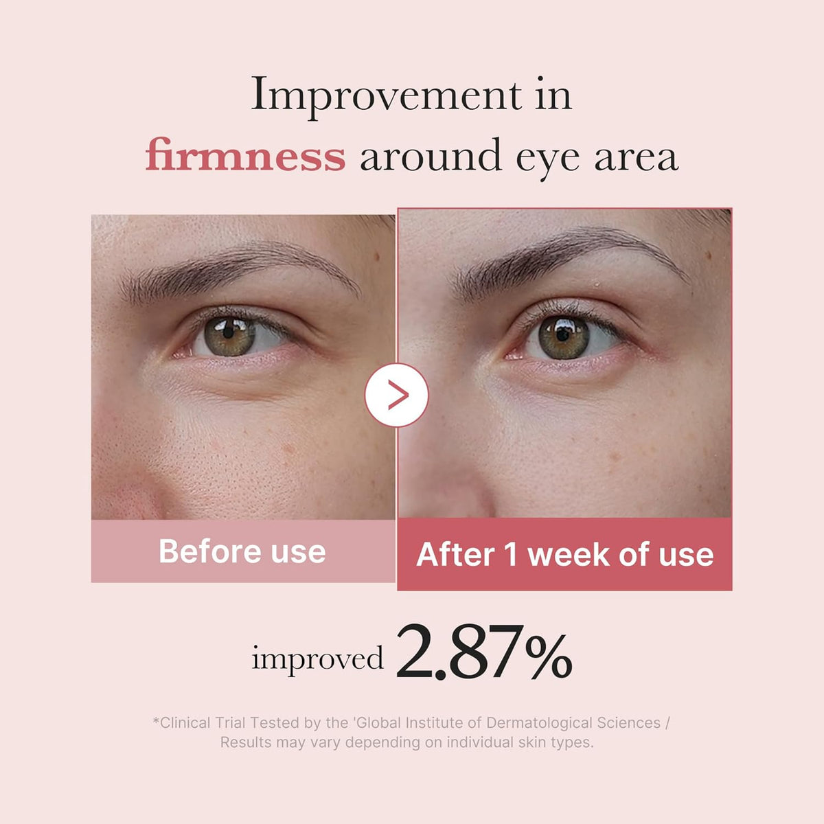 PDRN Pink Peptide Eye Cream